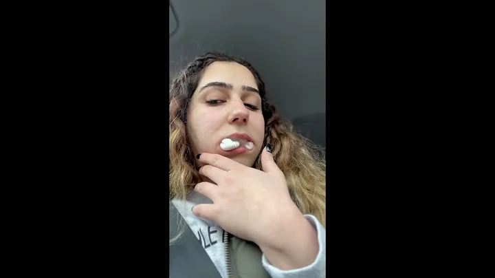 Did you take your wisdom teeth out yet? #wisdom #teeth #shortvideo #shorts