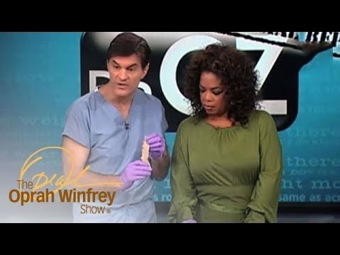 What Osteoporosis At 55