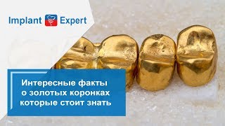 Интересные факты о золотых коронках, которые стоит знать