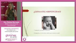 Dermatitis Herpetiforme. Conferencia de la Dra. Paloma Borregón