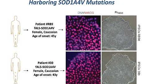 Probing disease mechanisms in ALS using iPSCs, reprogramming and optogenetic approaches - DayDayNews