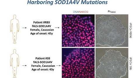 Probing disease mechanisms in ALS using iPSCs, reprogramming and optogenetic approaches