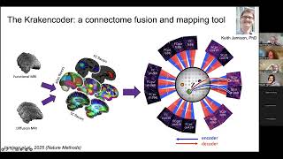 MakingConnections - Prof Amy Kuceyeski