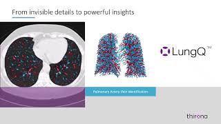 From invisible details to powerful insights - LungQu00ae AVX