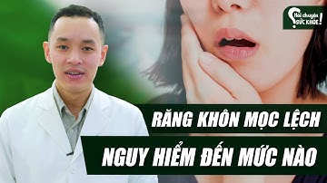 Hỏi chuyện sức khỏe | Răng khôn mọc lệch nguy hiểm đến mức nào?
