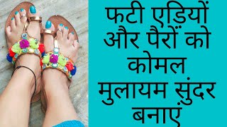 How To Get Baby Soft Feet |  Foot cream for rough and Dry heels | फटी एडिया्े पैरों को सुंदर बनाएं screenshot 5