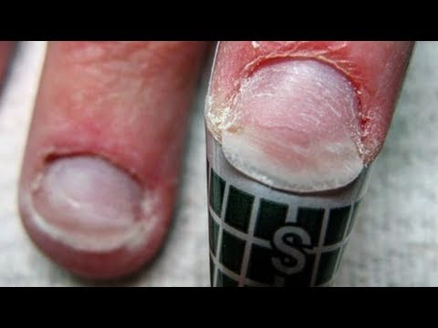 Video False Nails For Flat Nail Beds
