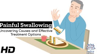 Swallowing Problems Unveiled: Causes and Remedies