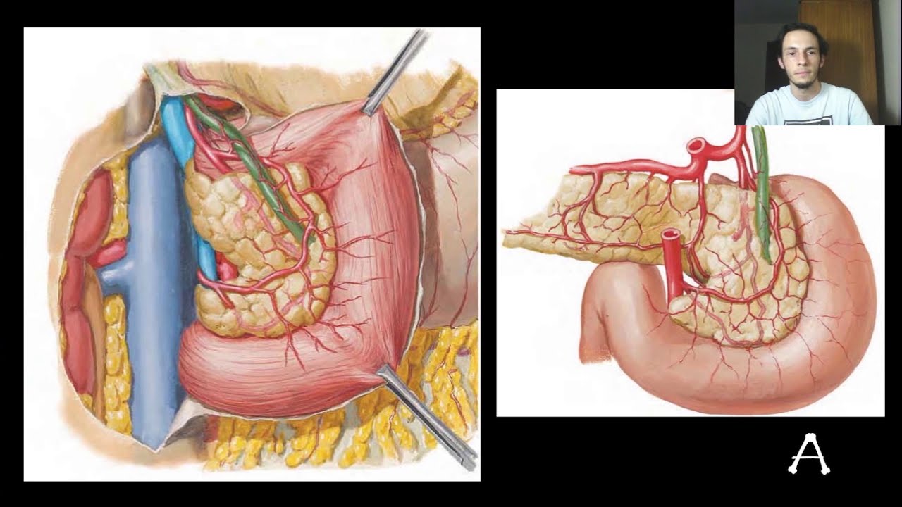 COLELITÍASE - Anatomia e Clínica