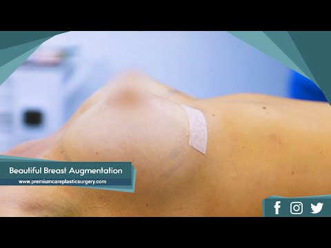Beautiful Breast Augmentation