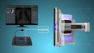 Persona RF PREMIUM Fluoroscopy System
