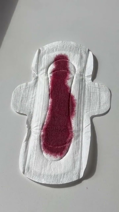 Light, medium, or heavy flow? 🩸 Tell us below