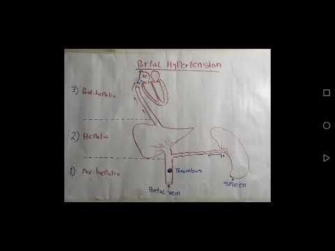 Portal hypertension