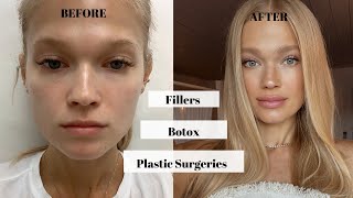 Everything I Did To Myself \/ TRUTH \/ Lip Fillers, Botox, Plastic Surgery? VS Model |  Vita Sidorkina