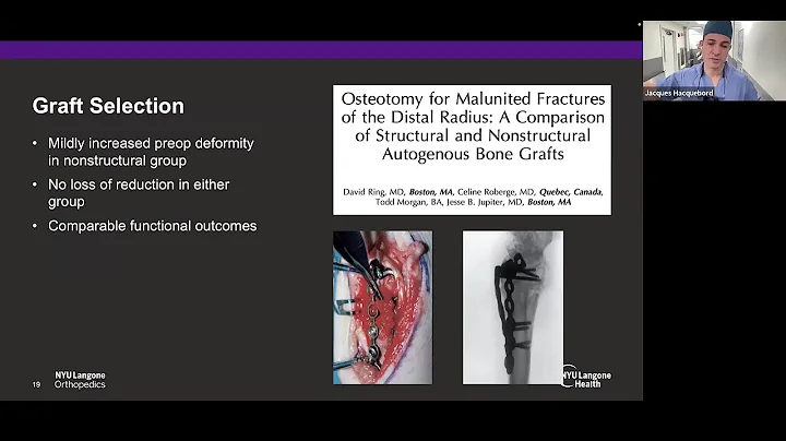 Osteotomies for Distal Radius Malunion, Jacques Hacquebord, M.D. | HOGR-HUP 2025