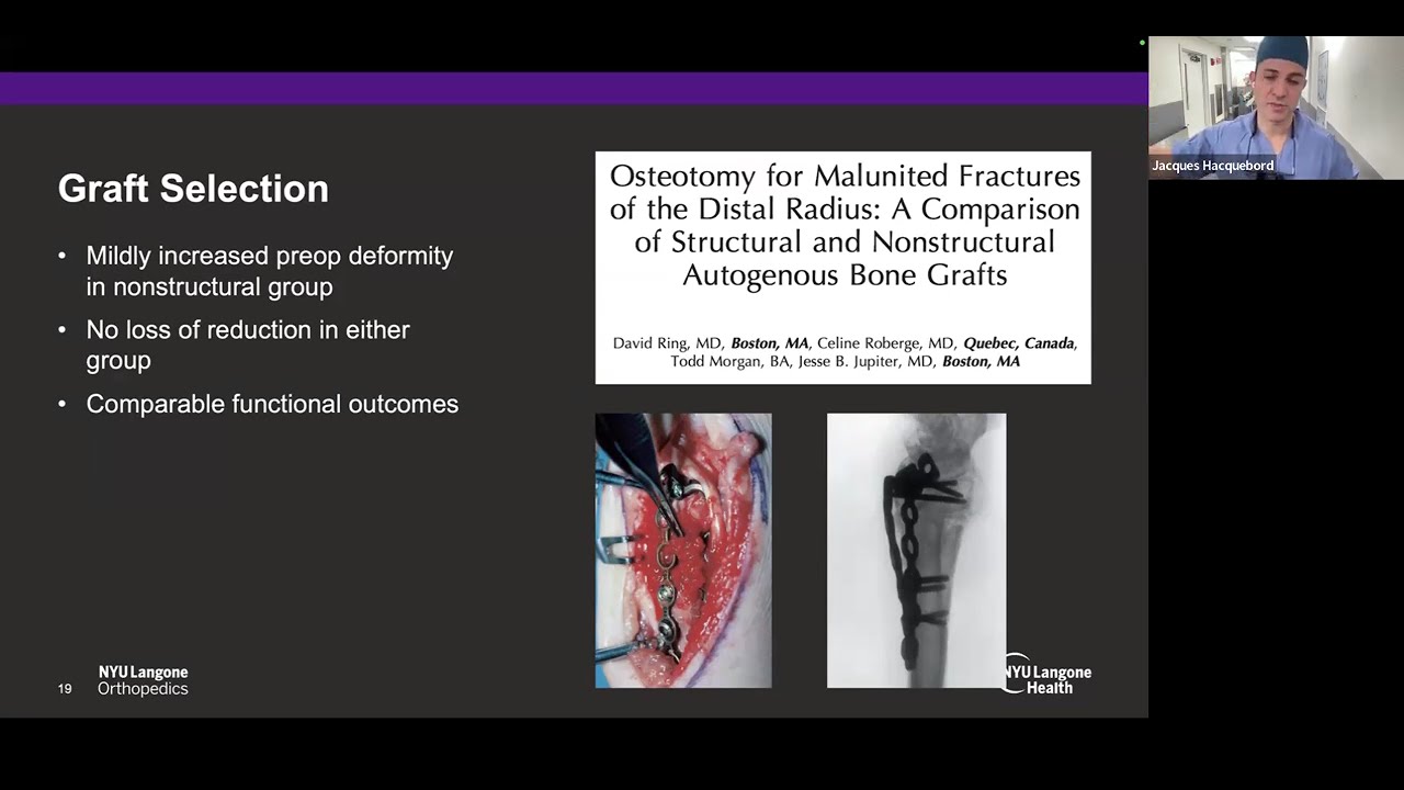 Osteotomies for Distal Radius Malunion, Jacques Hacquebord, M.D. | HOGR-HUP 2025