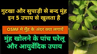 मुंह खोलने के 5 घरेलू और आयुर्वेदिक उपाय।। Muh kaise khulega , osmf treatment in hindi health tips