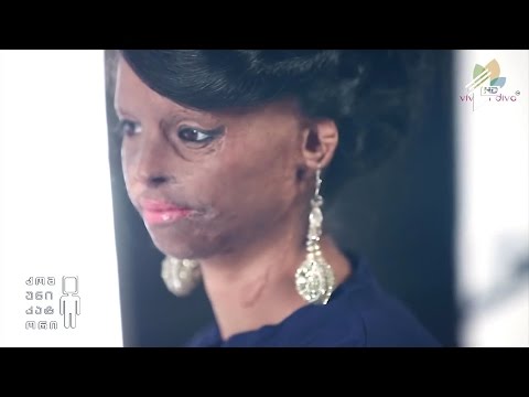 #StopAcidAttack შეევაჩეროთ შურისძიების უმკაცრესი ფორმა - სახეზე მჟავის შესხმა