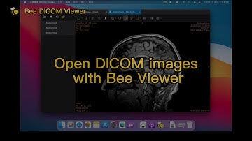 Open DICOM images with Bee Viewer