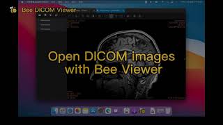 Open DICOM images with Bee Viewer screenshot 5