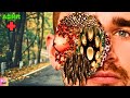 ASMR | Infected By Trypophobia Remove From Face | ASMR Urgent Treatment | ASMR Animation
