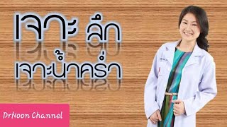 เจาะลึก "เจาะน้ำคร่ำ" | คนท้อง ต้องรู้ | DrNoon Channel