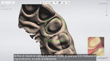 3Shape TRIOS - Scan page IT