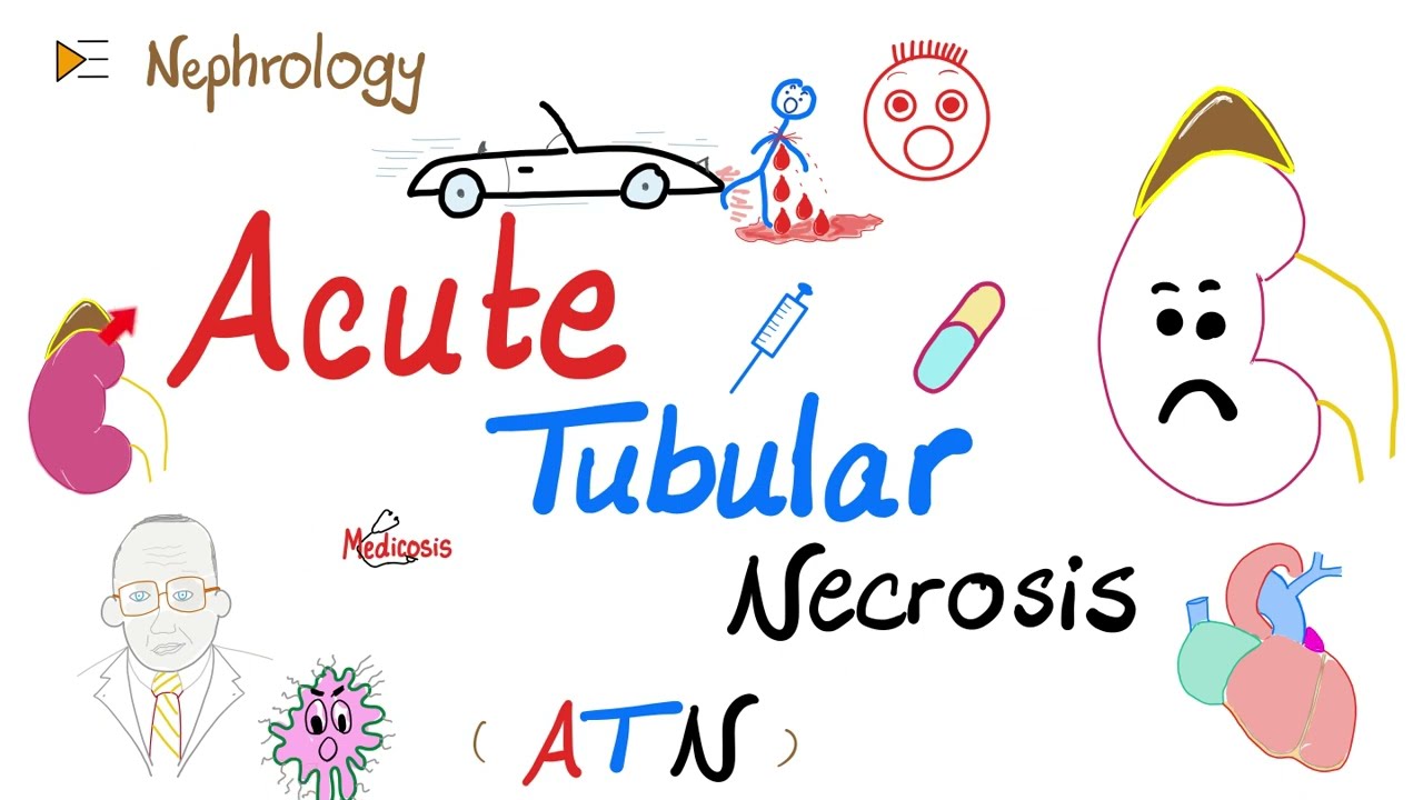 Acute Tubular Necrosis (ATN) - Azotemia - Acute Renal Failure (Acute Kidney Injury) - Nephrology