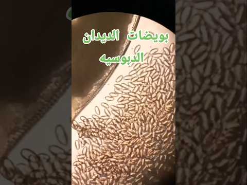 الديدان الدبوسية وهي تضع بيوضاتها تحت الميكرسكوب اكسبلور ديدان طفيليات  