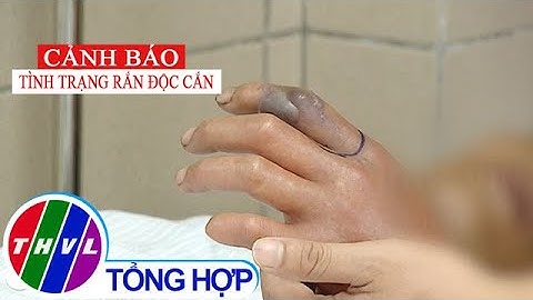 Cảnh báo tình trạng rắn độc cắn