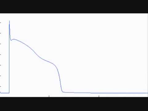 Andersen's Syndrome Luo-Rudy Model with Varying [K...