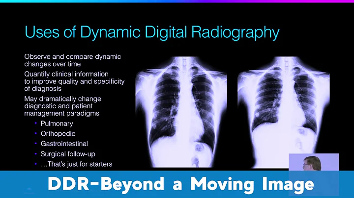 Dynamic Digital Radiography | Beyond a Moving Image | Konica Minolta Healthcare