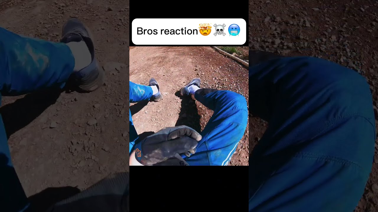 How I Broke Both My Wrists Mtb Fail Shorts