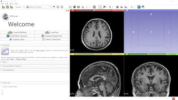 MRI only focused ultrasound treatment planning system in 3D slicer