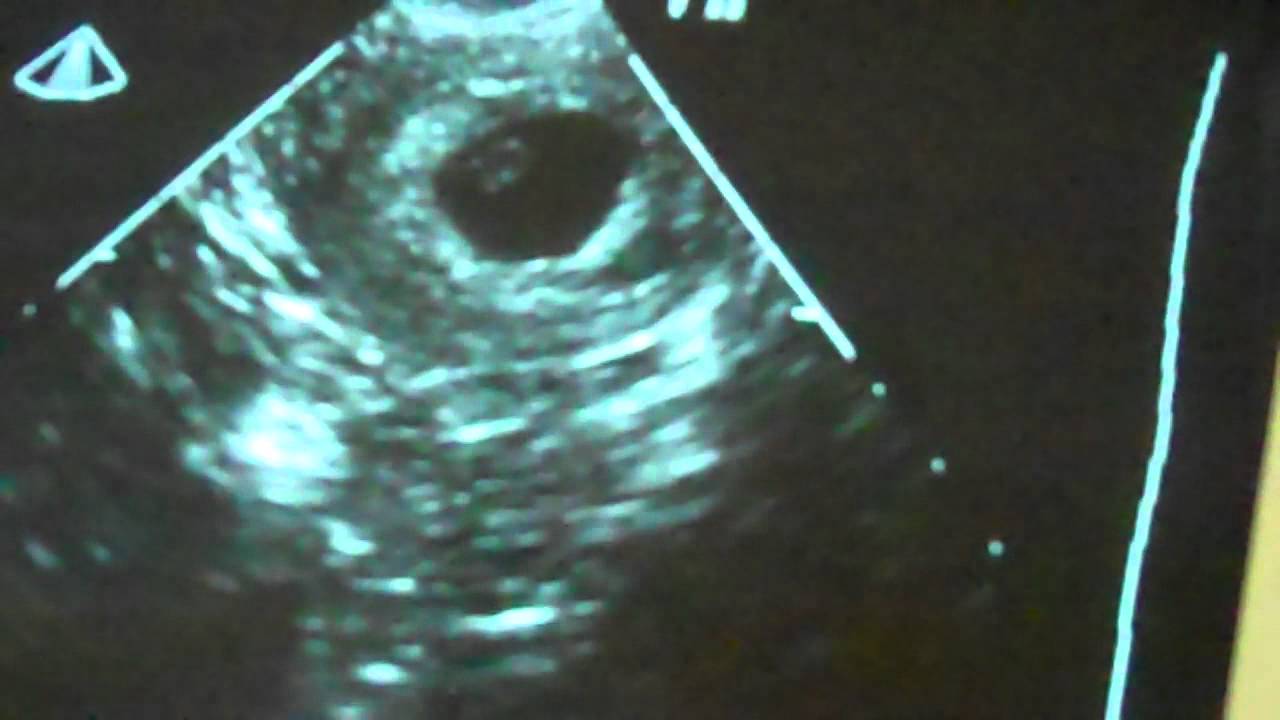 first-prenatal-appointment-and-ultrasound-from-hell-youtube