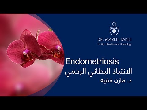 Endoemtriosis - الانتباذ البطاني الرحمي