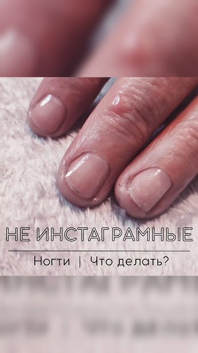НЕ ИНСТАГРАМНЫЕ РУКИ ~ Как обрабатывать запущенные ручки? Секреты ...