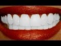 Astuce pour blanchir les dents teeth whitening
