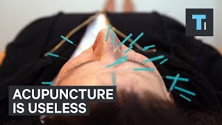 Acupuncture is useless