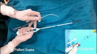 Mirena : how to insert| LNG-IUS | Hormonal IUD