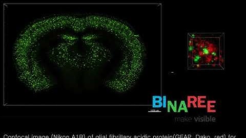 Amyloid beta plaques(thioflavin-S) analysis in Alzheimer