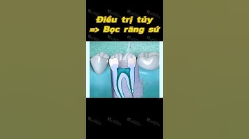 [3D] ĐIỀU TRỊ TỦY, BỌC RĂNG SỨ || Nha Khoa Quốc Tế Athena