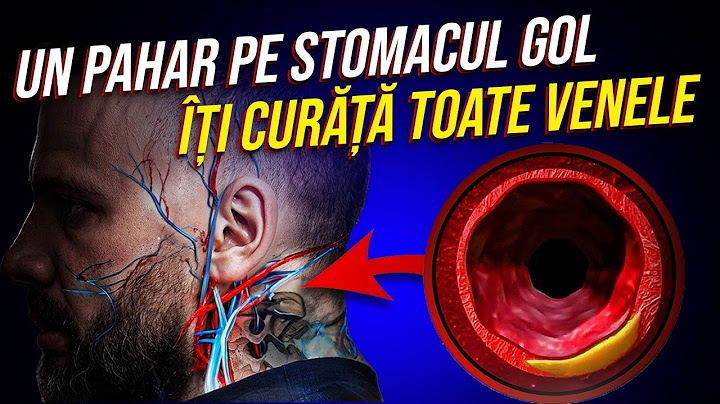 Un Pahar pe Stomacul Gol ca să nu Faci NICIODATĂ Accident Vascular Cerebral