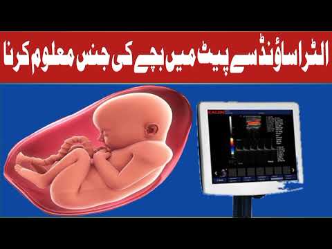 الٹراساؤنڈ کے ذریعے پیٹ میں بچے کی جنس معلوم کرنا