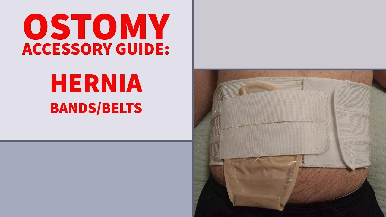 hollister ostomy hernia belt