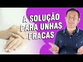 Unhas Quebradiças Nunca Mais! | Dr. Peter Liu