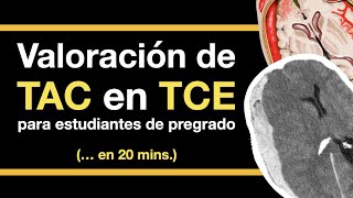 TCE en TAC en 20 minutos (para médicos no especialistas)