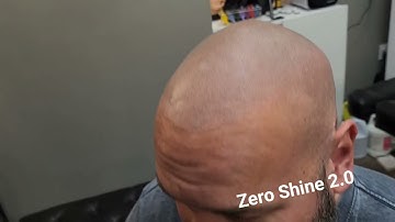 Zero Shine 2.0 in action for smp scalp mattifying.