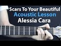 Scars To Your Beautiful - Alessia Cara: Acoustic Guitar Lesson EASY