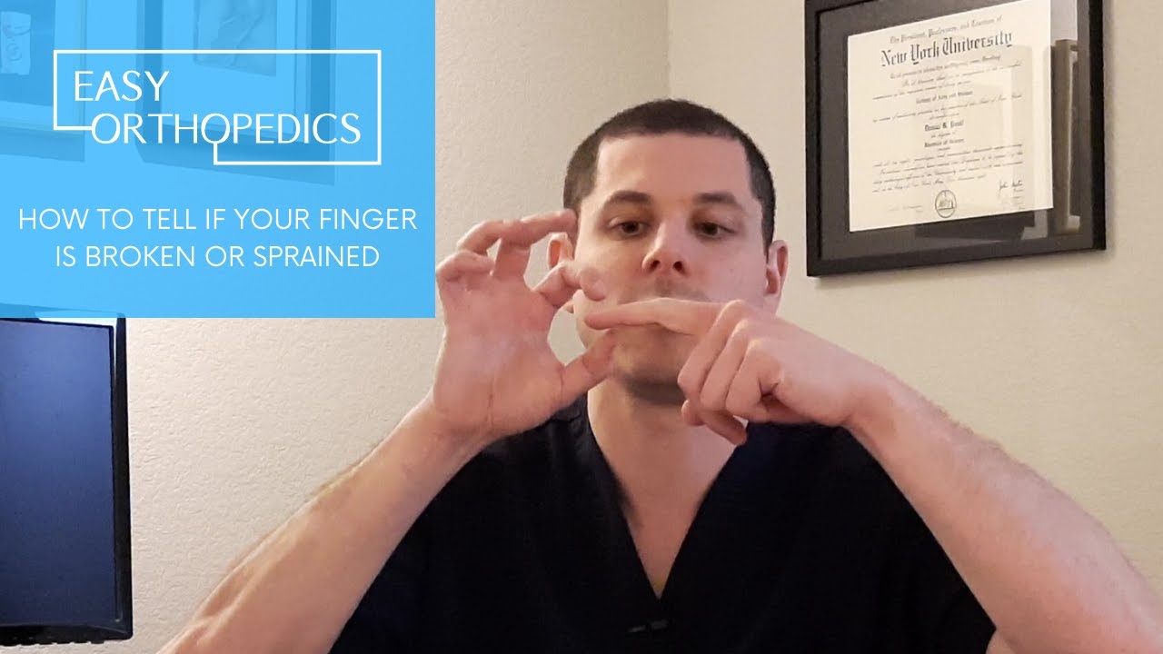 how to tell if finger is broken or sprained